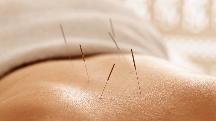 Acupuncture Helps Boost Your Sex Drive, Sex Life, and Pleasure
