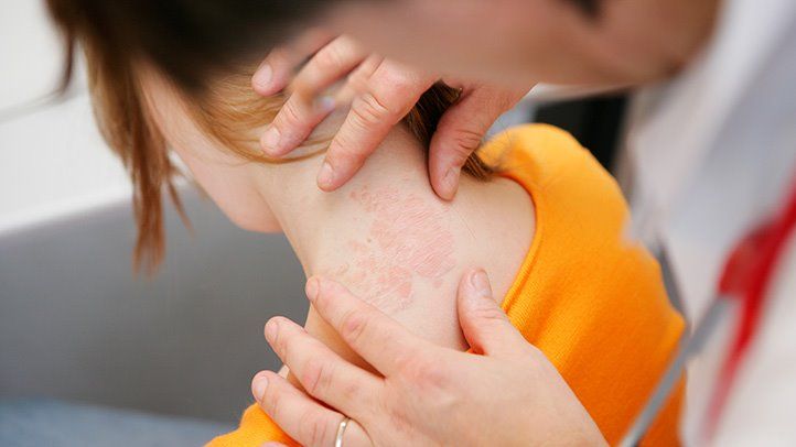 Doctors and Healthcare Providers Who Can Help You Manage Your Eczema