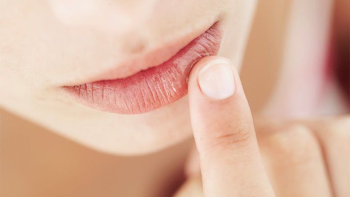 What You Need to Know About Chapped Lips