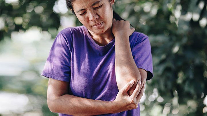 Signs and Symptoms of Psoriatic Arthritis