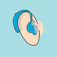 Behind-the-ear hearing aid with custom mold in ear illustration