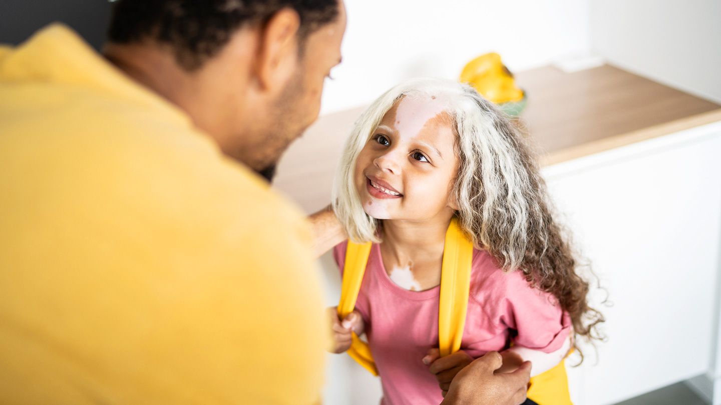 The Parent’s Guide to Caring for a Child With Vitiligo