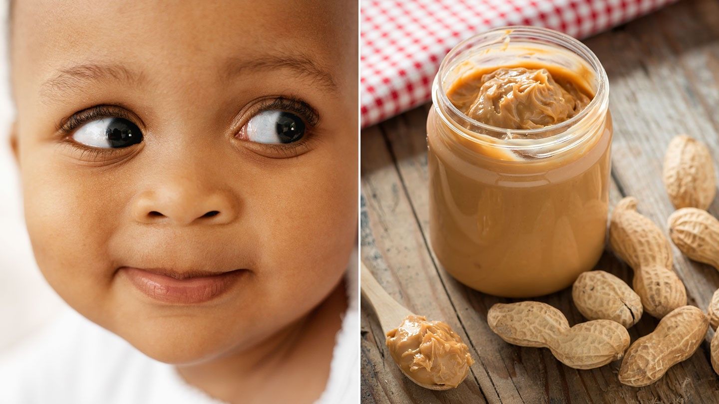 Kids’ Food Allergies, Especially to Peanuts, Are on the Rise
